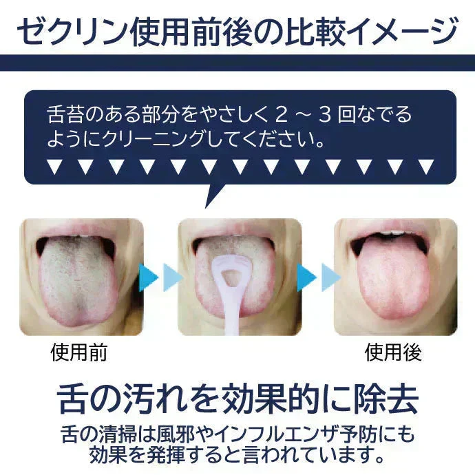 舌ブラシ ゼクリン (ソフトタイプ) 1本(袋入)【メール便送料無料】 ／ 舌クリーナー タンクリーナー 口臭予防