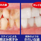 【薬用重曹ステインプロ】白い歯 自宅ケア ホワイトニング 自宅 簡単 歯の黄ばみ ヤニ 重曹 ポリン酸配合 簡単ケア 医薬部外品 オススメ プチプラ デンタルケア 通販 人気 ランキング アットコスメ おすすめ インスタ 話題 色素沈着 セルフ 口臭対策 口腔ケア デンタル オーラルケア 歯みがき 重曹 ミント マイノロジ