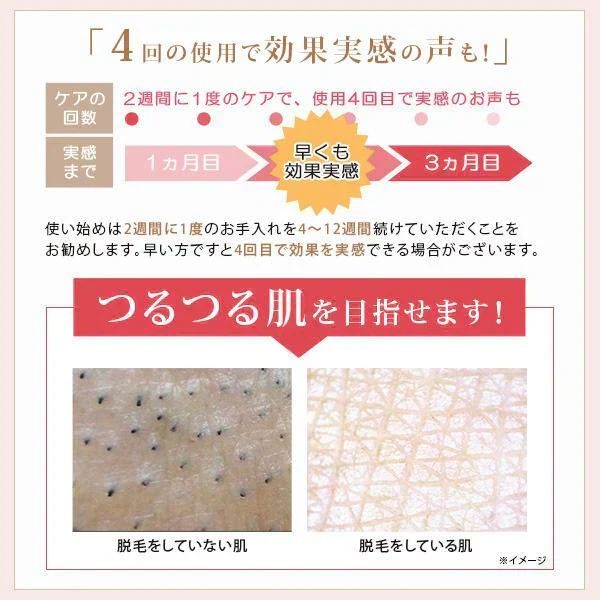 冷却光脱毛 イオンプルレエクラット