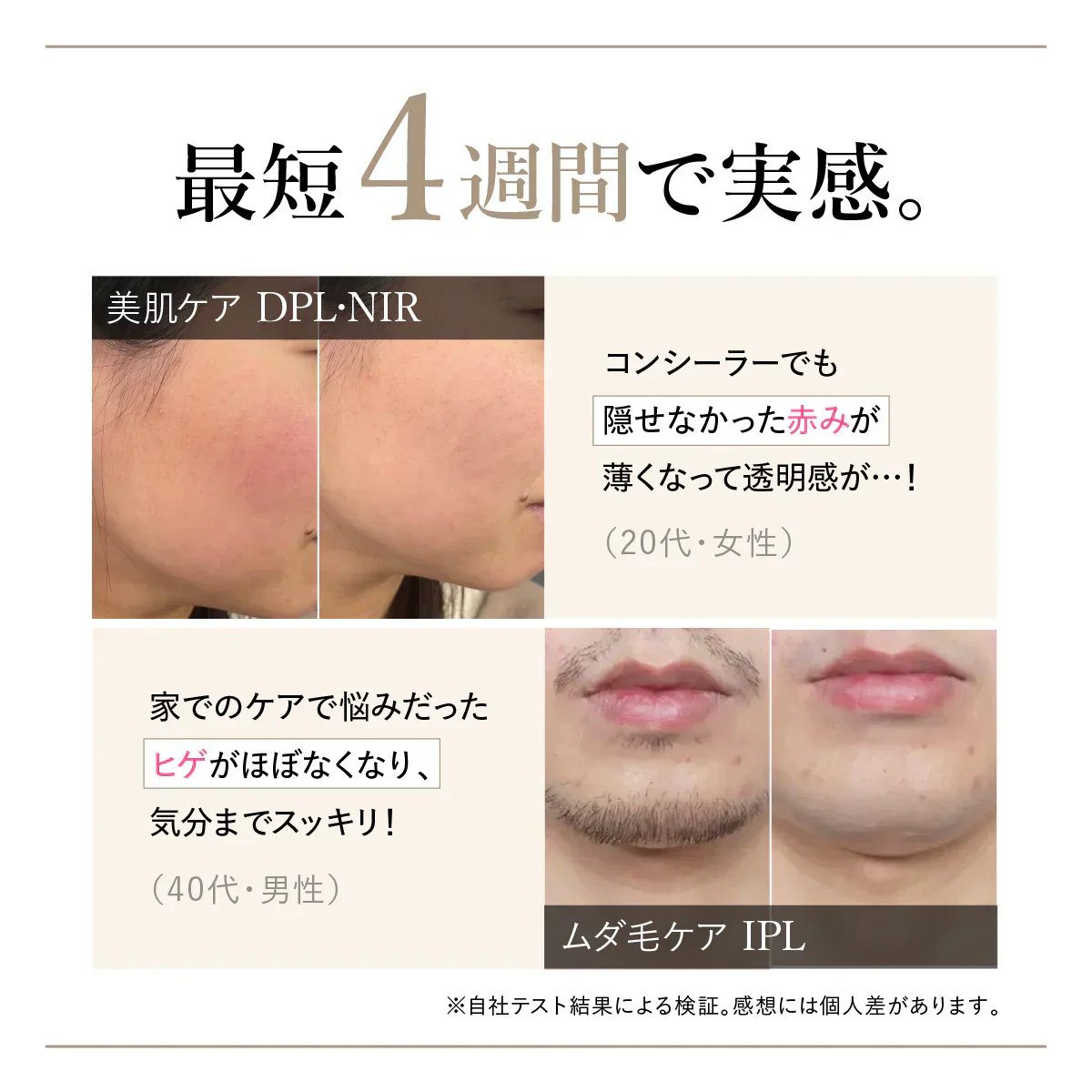 【WAVEWAVE Radiant Grace】ラディアント グレイス 脱毛 ムダ毛ケア IPL 3種の光美容ケア 0.1秒の最速照射 DPL 艶肌ケア うぶ毛 顔 ワキ 髭 ひげ セルフ脱毛 3種の光美容ケア　0.1秒の最速照射（国内最速）　DPL（艶肌ケア）×NIR（リフトケア）　IPL（ムダ毛ケア）　脱毛も美顔も 美顔器 レーザー美顔器 肌ケア