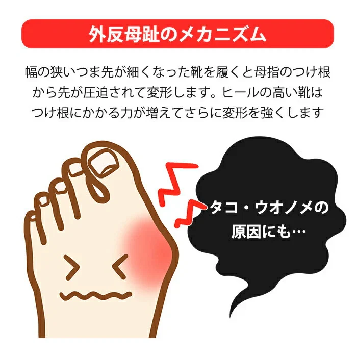 【チャコールグレー】外反母趾 サポーター 寝る時  靴下 矯正 五本指ソックス 足指広げる 足指セパレーター メンズ レディース 日本製 / ロコメイト 母趾保護サポートソックス