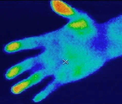 【つけるだけで痩せる】磁気ダイエットリング 血行促進 スリムハート 磁気アクセサリー 磁気リング リング 指輪 レディース ハート かわいい ツボ押し ダイエットリング 指輪 ダイエット 健康 プレゼント ギフト