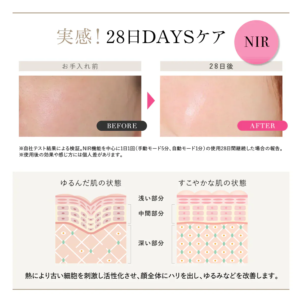 【WAVEWAVE Radiant Grace】ラディアント グレイス 脱毛 ムダ毛ケア IPL 3種の光美容ケア 0.1秒の最速照射 DPL 艶肌ケア うぶ毛 顔 ワキ 髭 ひげ セルフ脱毛 3種の光美容ケア　0.1秒の最速照射（国内最速）　DPL（艶肌ケア）×NIR（リフトケア）　IPL（ムダ毛ケア）　脱毛も美顔も 美顔器 レーザー美顔器 肌ケア