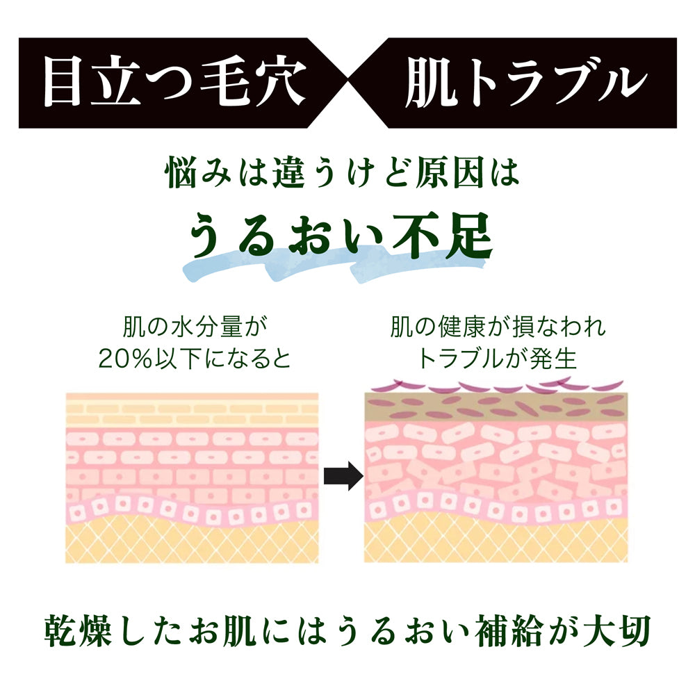 5種のヒアルロン酸配合スキンローション 600ml◆ 化粧水 おすすめ 潤い 美白 大容量 お徳用 スキンケア メンズ 男女兼用 無添加 無香料 乾燥肌 敏感肌 保湿