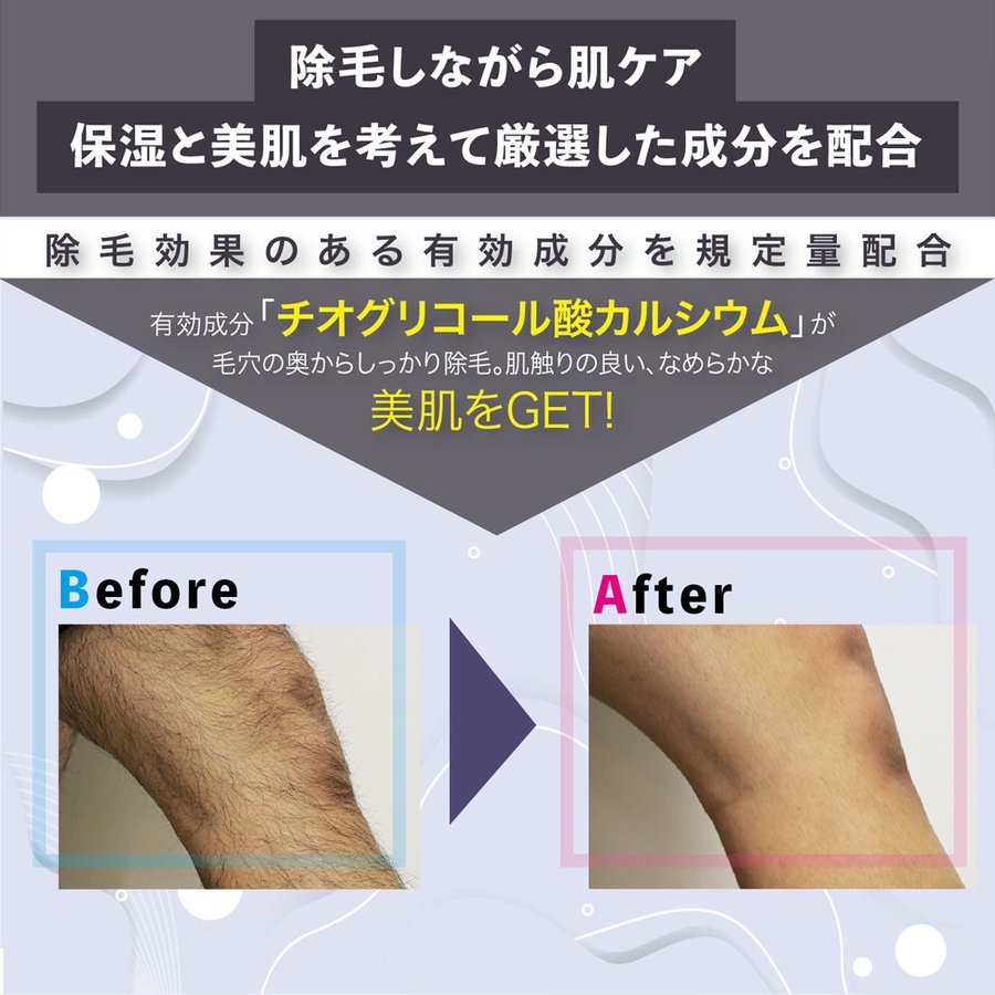 除毛クリーム SP REMOVE １本  エスピーリムーブ 除毛 すべ肌 ケア ジェンダーレス 送料込み ※一部地域を除く