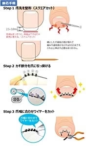 【送料無料】NEWまきづめリフト　爪やすり付き　巻きづめ　巻き爪矯正