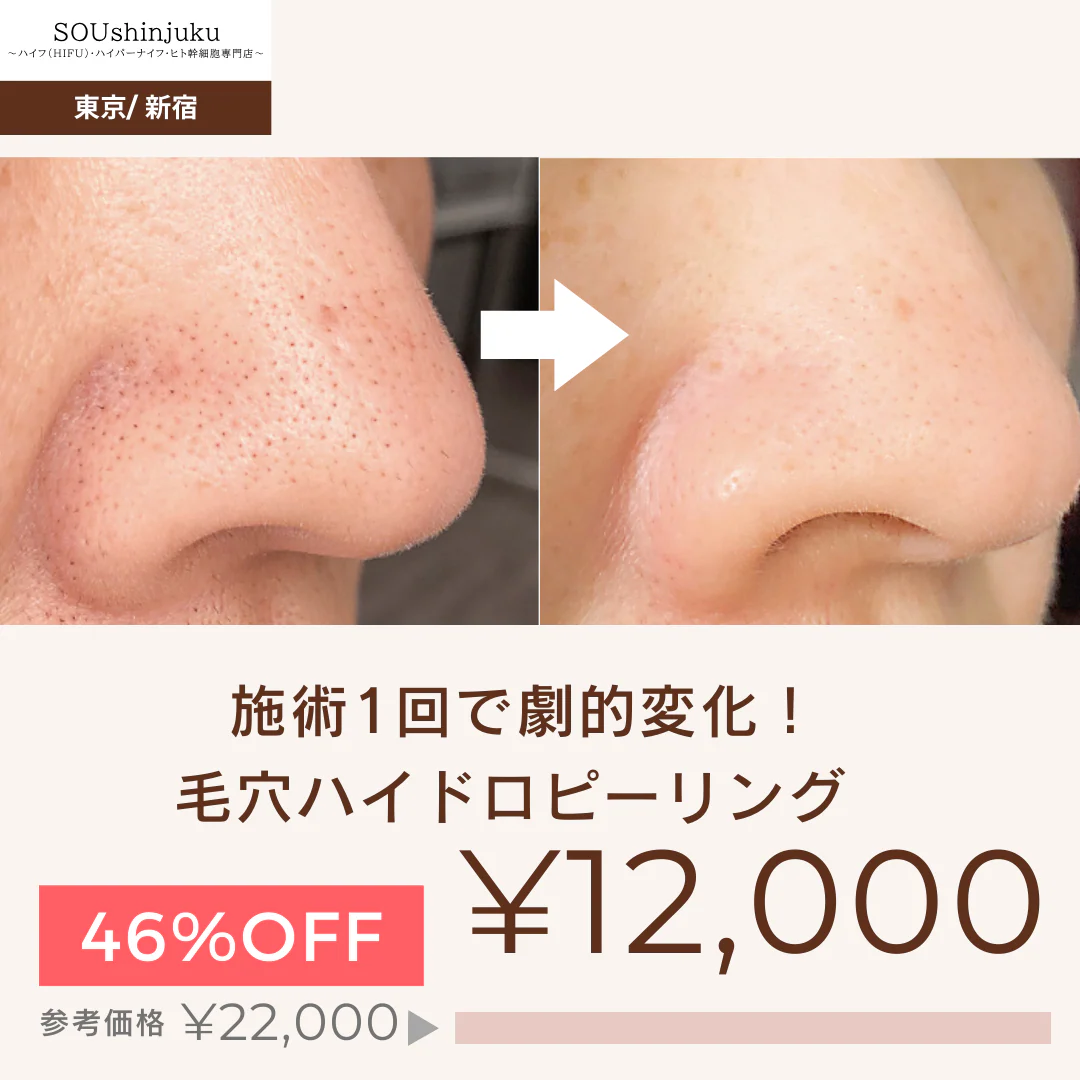 【再来限定】[全顔の毛穴洗浄♪毛穴の汚れ,開きに☆]毛穴ハイドラフェイシャル　【美容サロンチケット】美容/エステ/フェイシャルエステ/東京/新宿/メディカライクサロンSOU新宿