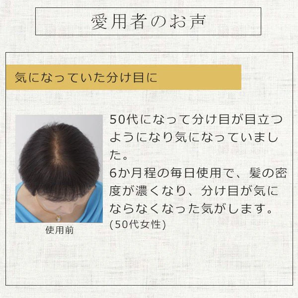 ヘアーモーメントＰ グロウエッセンス 155ml 育毛剤 女性用 養毛 育毛 薄毛対策 薄毛 抜け毛予防