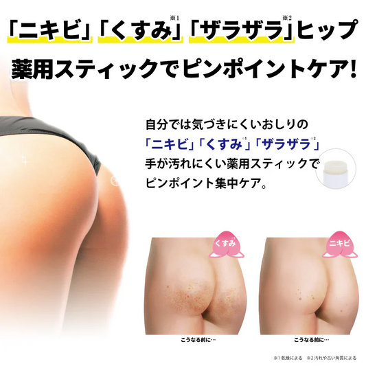 【魅惑のおしりスティック】気になるおしりをピンポイントケア ヒップケア  ニキビや乾燥によるくすみ 角質汚れによるザラザラを手を汚さずにケアお尻 ニキビ予防 くすみ ザラザラ 美白 保湿 薬用有効成分 手が汚れないスティックタイプ 集中ケア 医薬部外品  おしり用薬用スティック にきび くすみ ザラザラ ヒップ