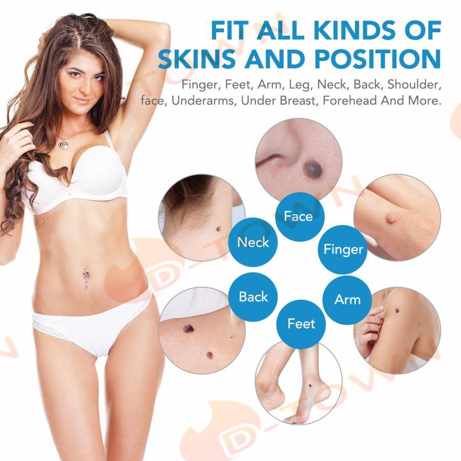 イボ Skin Tag Remover スキンタグ除去キットSEFUDUN 、2-8mm 家庭用いぼ除去装置、マイクロスキンタグ治療ツール、スキンケアツールセット