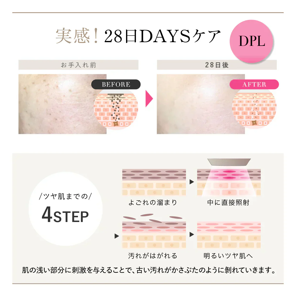 【WAVEWAVE Radiant Grace】ラディアント グレイス 脱毛 ムダ毛ケア IPL 3種の光美容ケア 0.1秒の最速照射 DPL 艶肌ケア うぶ毛 顔 ワキ 髭 ひげ セルフ脱毛 3種の光美容ケア　0.1秒の最速照射（国内最速）　DPL（艶肌ケア）×NIR（リフトケア）　IPL（ムダ毛ケア）　脱毛も美顔も 美顔器 レーザー美顔器 肌ケア