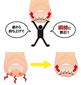 【送料無料】NEWまきづめリフト　爪やすり付き　巻きづめ　巻き爪矯正