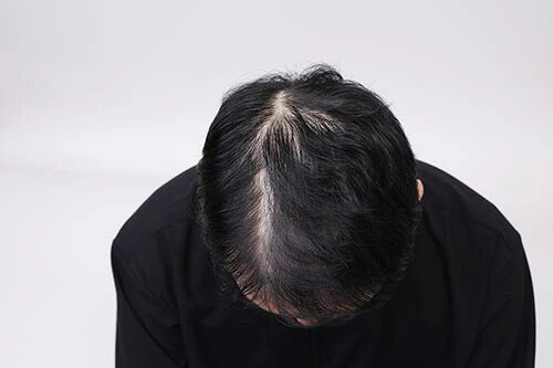 薬用育毛エッセンス ターゲットグロウ 100ml  エッセンス 育毛剤 男性用 育毛ローション 育毛 育毛促進トニック 薄毛 抜け毛 対策  薬用