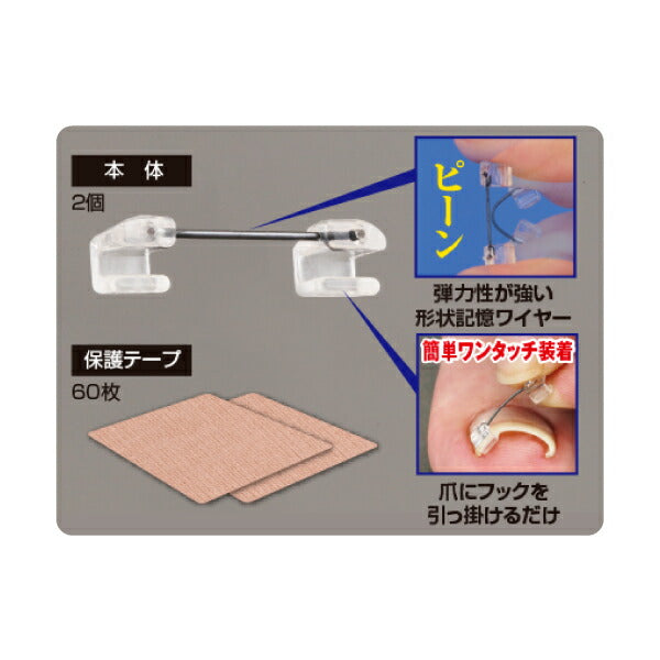 巻き爪ワイヤーガード 1セット(2個) 巻き爪の痛みをその場で緩和【メール便送料無料】