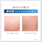 しみ 薬用美白原液エビスビーホワイト10ml トラネキサム酸 グリチルリチン酸ジカリウム 肌荒れ ニキビ メB
