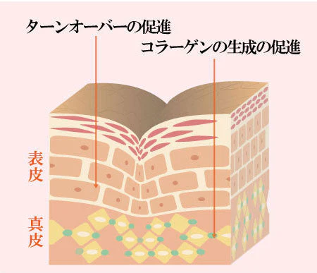 首元 ヒト幹細胞 美容液 首の シワ/タルミ/シミ エイジング スキンケア 40代 50代 60代 / トミーリッチ ネックリンクルジェルSP