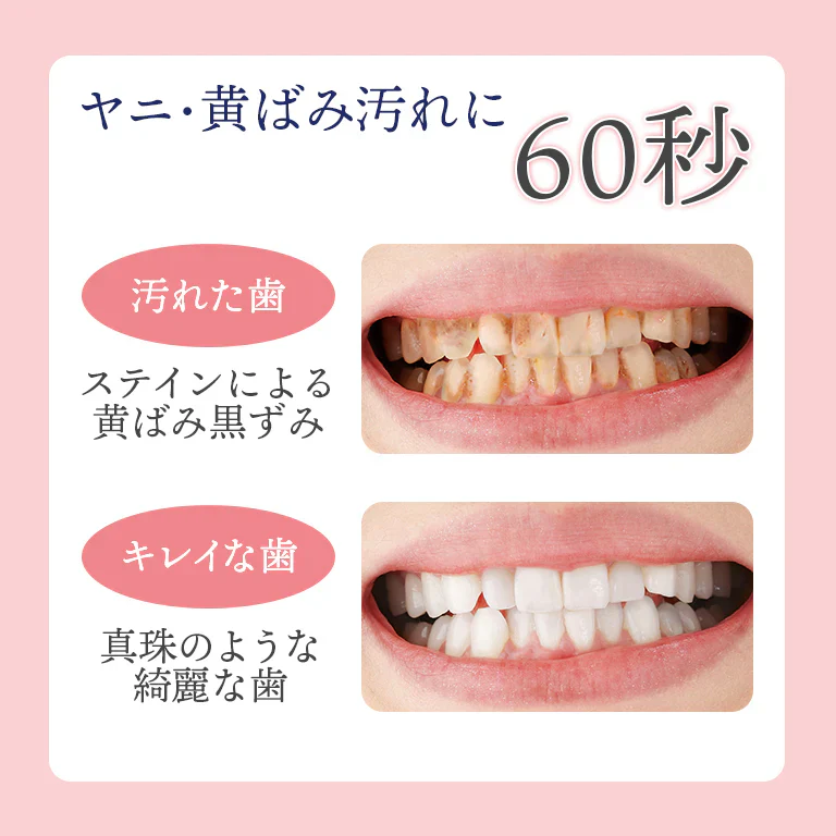 薬用重曹ステインプロ プノン 【美容液に香りをプラス オーラルケア デンタルケア マウスケア 液体歯磨き ステイン 着色汚れ 口臭】医薬部外品 デンタルケア オーラルケア 重曹 ハミガキ ホワイトニング デンタルケア マウスケア 液体歯磨き ステイン ヤニ汚れ 着色汚れ 口臭 ワイン コーヒー 歯を白く 自宅で簡単 ケア