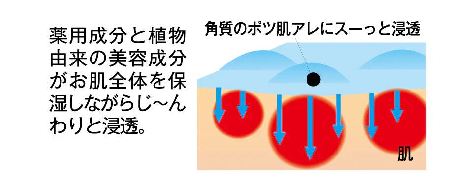 ツブ・ナイトK　ゲル【顔　首元　目元　ポツポツ　角質粒】【パックタイプと併用で効果的！　日本製】