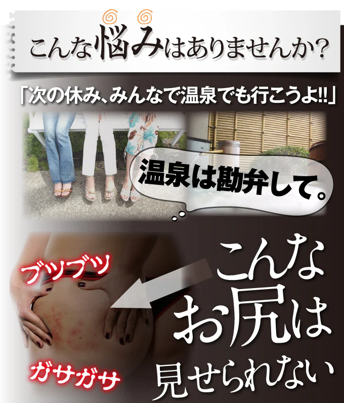 OK-II（オッケーツー）【医薬部外品】(お尻クリーム おしりケア 肌荒れ 乳液 薬用 魅惑のおしり お尻 おしり お尻ニキビ にきび お尻ケア ブツブツ お尻にきび 背中ニキビ スベスベ 人気 楽天 OKII ヘルシーライフ ) ビューティ ボディケア オイル ミルク 薬用 肌荒れ 乳液 お尻 おしり お尻ニキビ にきび お尻ケア ニキビ ブツブツ お尻にきび 背中ニキビ ツルツル スベスベ