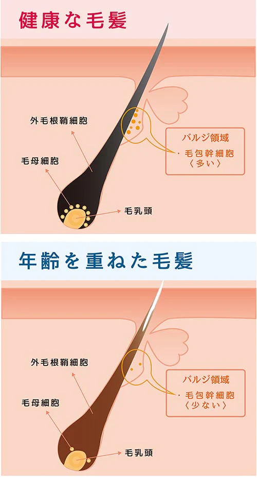 薬用育毛エッセンス ターゲットグロウ 100ml  エッセンス 育毛剤 男性用 育毛ローション 育毛 育毛促進トニック 薄毛 抜け毛 対策  薬用