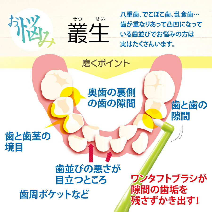 【3人シェア買いでお得】ペングリップワンタフトブラシ MSやややわらかめ 10本セット ※お色は選べません【Ciメディカル 歯ブラシ】