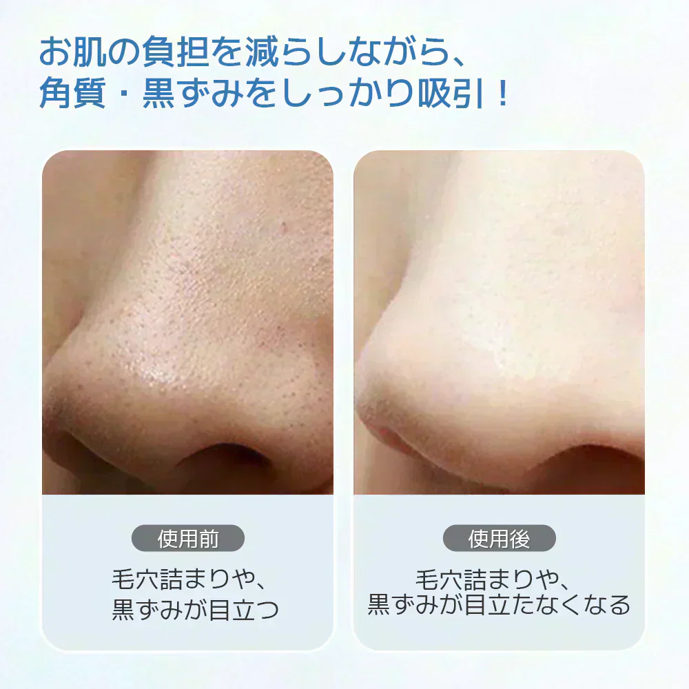 毛穴吸引器 サーリシ 光エステ 毛穴吸引 毛穴吸引機 毛穴ケア 毛穴 吸引 角質ケア 黒ずみ 鼻 角栓 コンパクト毛穴クリーン 5種類吸引ヘッド 美肌 Sarlisi ABF090