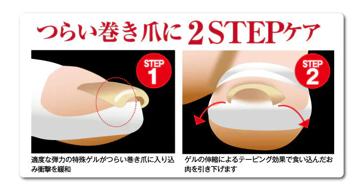 【巻き爪ゲルテクト ハード】辛い巻き爪をしっかりサポートつらい巻き爪の食い込みを緩和する 2STEP徹底ガードのハードタイプが新登場! 巻き爪 食い込み緩和 テーピング 付けるだけ簡単 衝撃を緩和 美容外科医監修 くならない ワイヤー クリップ テープ 巻き爪用クリップ 食い込み緩和 テーピング 付けるだけ 目立たない 巻き爪保護グッズ ベージュ 肌色 送料無料 衝撃緩和 巻爪 まきつめ