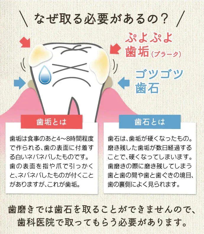 ヤニ取り＆歯石取り＆歯垢取りホームケア3点セット《スケーラー H5-33 1点・検診専用ミラー1点・Ciプラークチェッカー(歯垢染色液)ミニボトル(5ml)1点》【メール便送料無料】