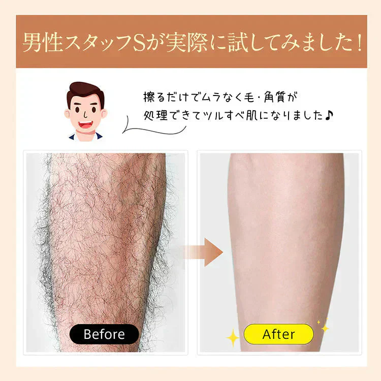 ガラス脱毛器【ローズゴールド色】  ガラスリムーバー こするだけ こするだけ脱毛 女性 ムダ毛処理 除毛 ナノガラス【カウシェファーム収穫対象商品】