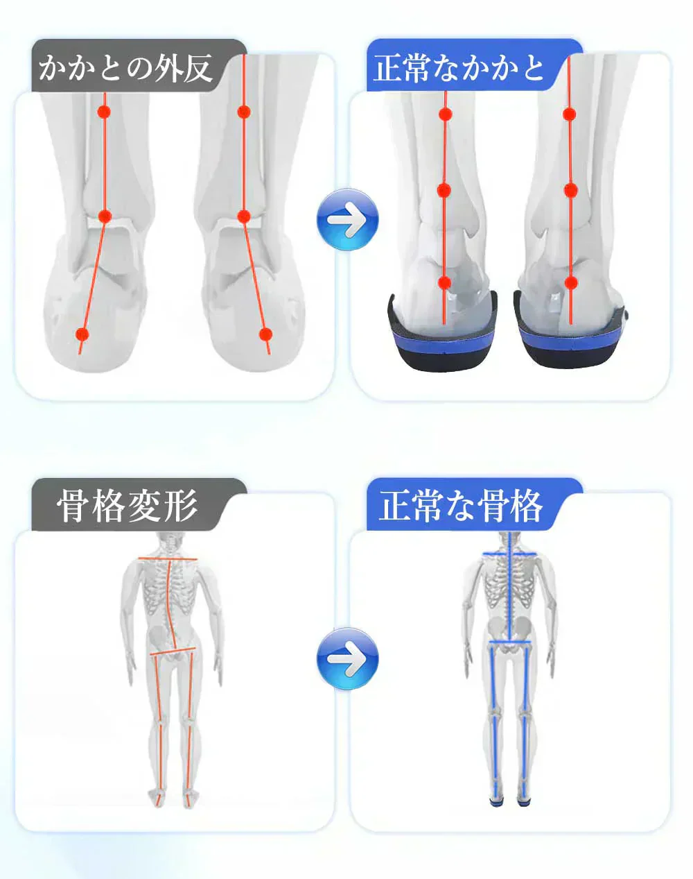【快適な歩行を実現！】＼ XSサイズ ／高品質 インソール 衝撃吸収 衝撃 インソール 扁平足 外反母趾 足底筋膜炎 インソール 通気性 抗菌 防臭 負担対策 サポート機能 疲れない 軽量 履き心地 疲れにくい ゴルフ 靴 グッズ 中敷 メンズ レディース 蒸れ防止 抗菌防臭 特殊4層槽造 インソール
