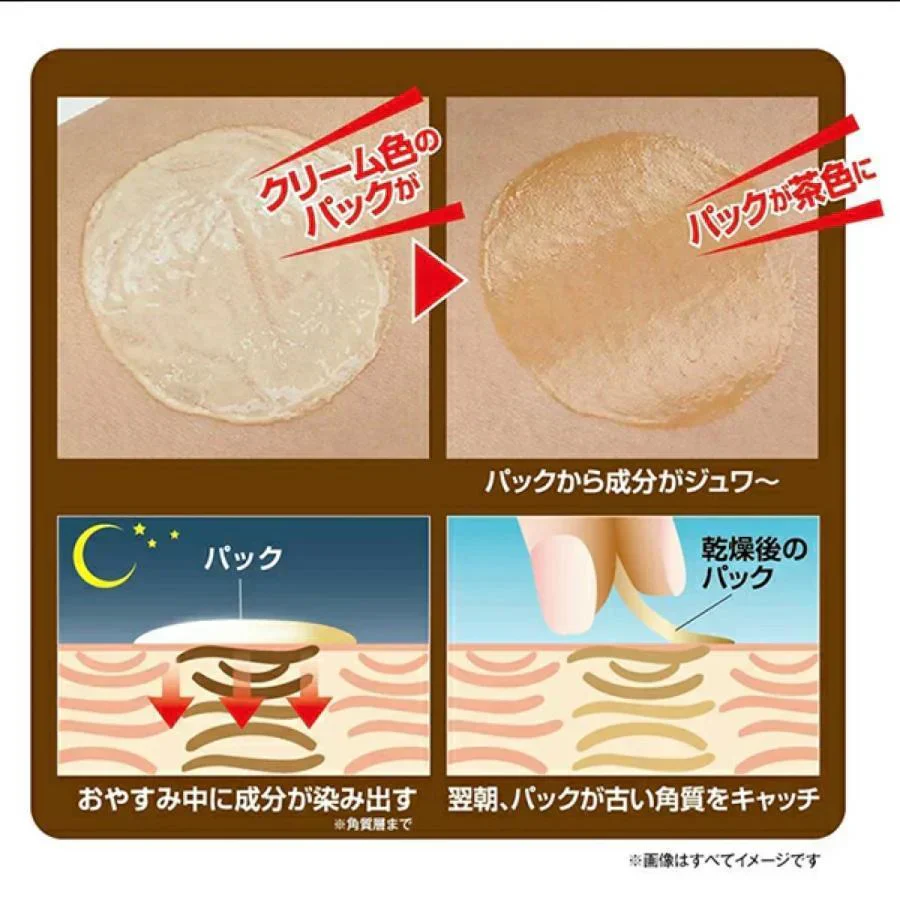 【アトネールEX 15g】 気になるところに『塗る』『寝る』『はがす』の簡単吸着パック 足の角質ケア クリーム パック 足 黒ずみ 角質 硬化 黒ずみケア 角質 ケアクリーム かかと 摩擦跡 角質硬化 黒ずみ対策 乾燥や摩擦で気になるパーツに塗って寝るだけ 古い角質をキャッチ 足の色素沈着ケア 角質硬化 吸着パック 黒ずみ フット きれい足  足ケア あしケア  角質ケア フットクリーム ボディケア フットケア デオドラント フットデオドラント