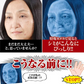 【薬用 クロパックン プレミアム30g】医薬部外品 しみ ピーリング 吸着パック 集中ケア 化粧品 黒ずみ メラニン 肌荒れ にきび 簡単10分ケア 塗るだけの集中ケア しみ そばかす シミ ケア くすみ 黒ずみ 薬用 ピーリング 吸着 シワ 肌荒れ対策 薬用 美白 パック 美容 美容液 日本製 しわ 小じわ 美白 白肌 そばかす メラニン 日本製