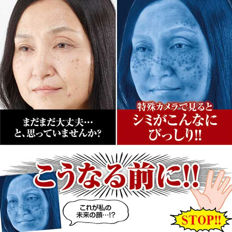 【薬用 クロパックン プレミアム30g】医薬部外品 しみ ピーリング 吸着パック 集中ケア 化粧品 黒ずみ メラニン 肌荒れ にきび 簡単10分ケア 塗るだけの集中ケア しみ そばかす シミ ケア くすみ 黒ずみ 薬用 ピーリング 吸着 シワ 肌荒れ対策 薬用 美白 パック 美容 美容液 日本製 しわ 小じわ 美白 白肌 そばかす メラニン 日本製