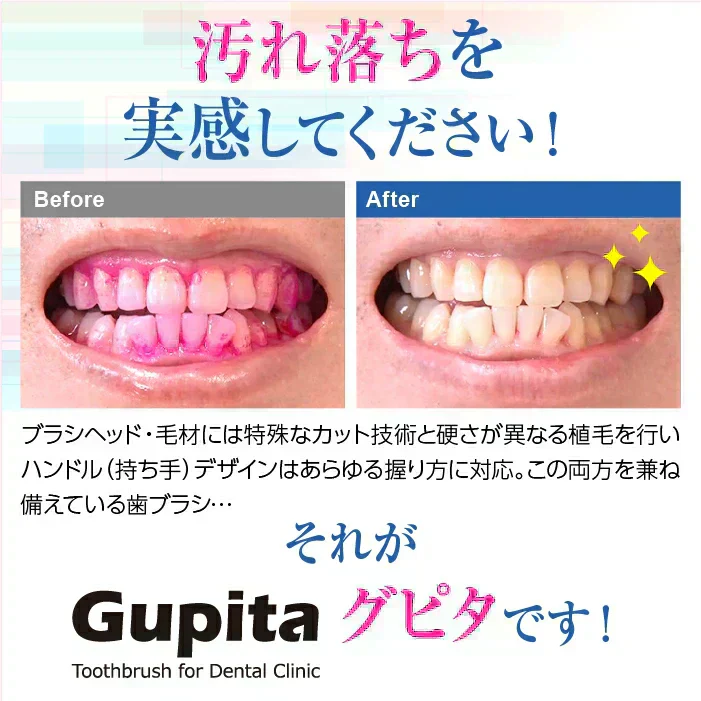 歯科専用歯ブラシ Gupita グピタ (毛のかたさ：Mふつう) 20本セット ／ 理想の歯ブラシ 全5色 個包装 ／ 復興支援商品【メール便送料無料】