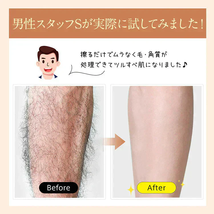 ガラス脱毛器【ブラック色】  ガラスリムーバー こするだけ こするだけ脱毛 女性 ムダ毛処理 除毛 ナノガラス【カウシェファーム収穫対象商品】