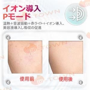 美顔器 リフトアップ クマ ほうれい線 フェイスライン スキンケア 美容 ハリ ツヤ SPA 光エステ 毛穴 汚れとり 角質ケア w614