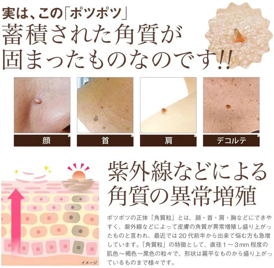 お得2個セット【イポケアEX】首元やフェイスラインのポツポツを集中ケア！年齢肌にうるおいプラス！美容液  角質 ケア スキンケア 顔 首筋 胸元 イボ ポツポツ バチルス発酵液 ヨクイニンエキス ウワウルシ葉エキス イポケア 送料無料 ポツポツ専用 美容液 いぼ取り 除去 お肌のポツポツ 角質 ケアバチルス発酵液 18ml 顔 首 肩 胸 美容 ケア お肌 ボディケア ぶつぶつ 日本製 おすすめ 人気 ランキング 効果 強力 最強 角質ケア