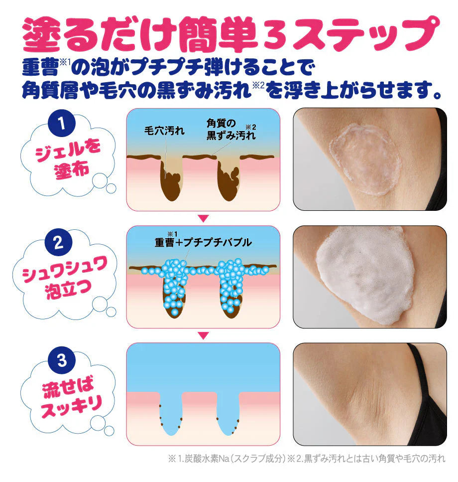 ぷっくぷく重曹　ワキ泡　プレミアムパック 【重曹　炭酸　ワキ専用　頑固な黒ずみ　汚れ　ポツポツ　角質ケア　ターンオーバー】【塗るだけ　洗い流す　簡単　90秒】【シャボンの香り】　簡単3ステップでワキの黒ずみ対策! 重曹バブルのワキ用泡パック