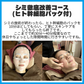 【新規限定】シミ徹底改善コース(ヒト幹細胞パック付)　【美容サロンチケット】美容/エステ/フェイシャルエステ/東京/新宿/メディカライクサロンSOU新宿