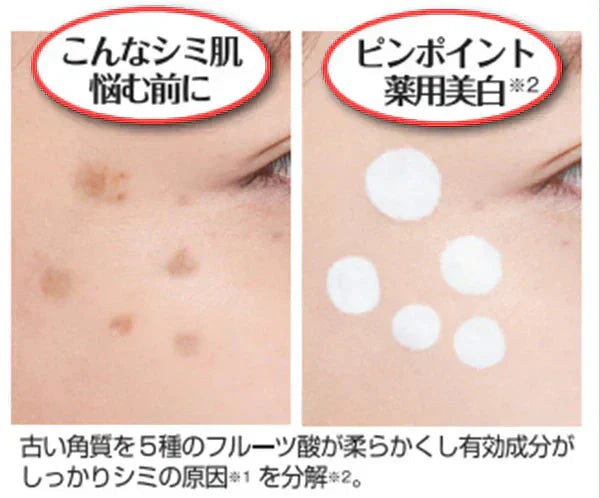 薬用シミネールEX 【シミ メラニン 寝ながら美容 集中美白ケア 薬用美白パック プラセンタ ビタミンC 医薬部外品】 医薬部外品 メラニン そばかす 塗って 「塗る」「寝る」「はがす」の薬用美白パック！ シミの根源にジワジワ浸透し 無力化 ※美白成分が染みでてシミを根本からしっかりブロック 古い角質を5種のフルーツ酸が柔らかくし、有効成分がしっかりシミの原因を分解