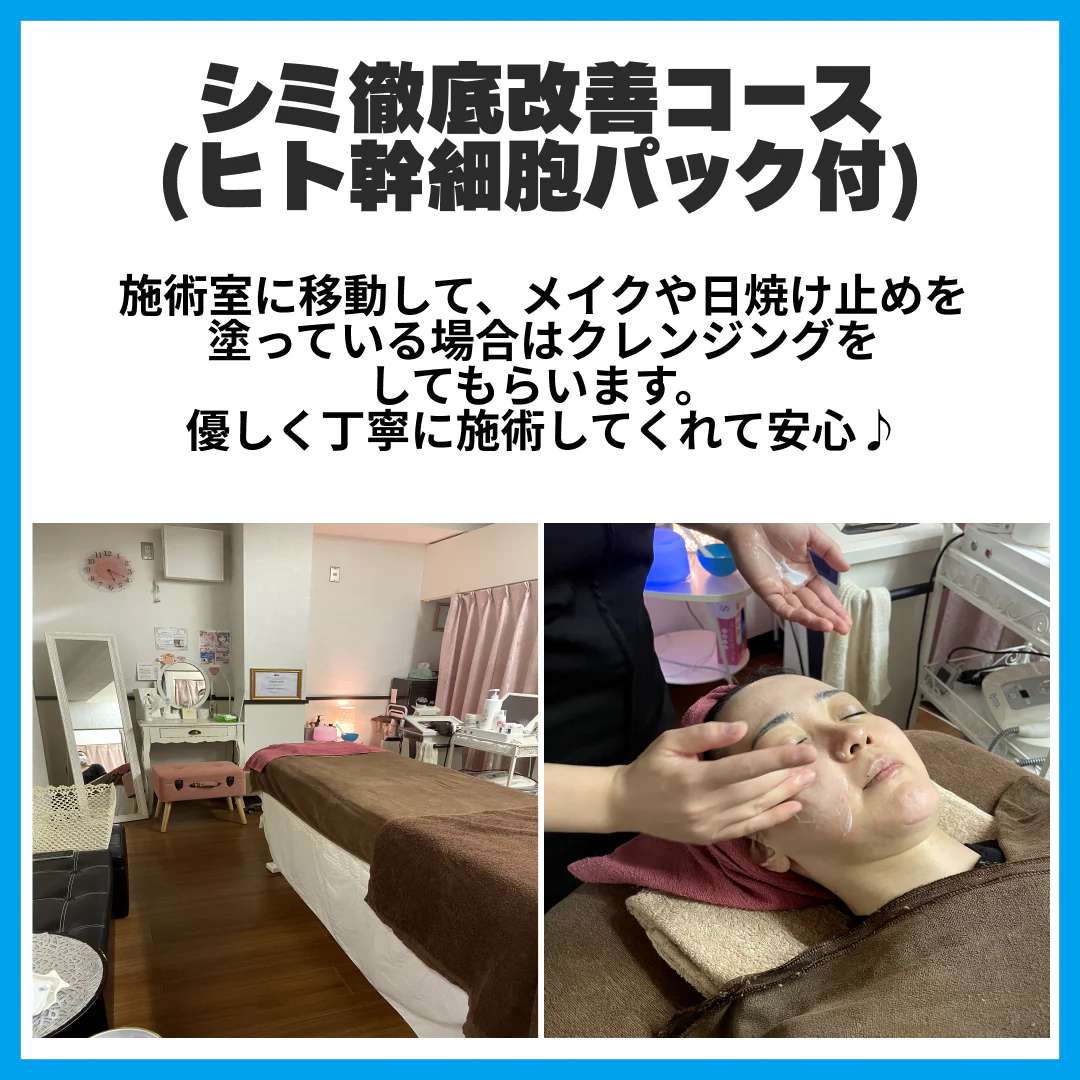 新規限定】シミ徹底改善コース(ヒト幹細胞パック付) 【美容サロン