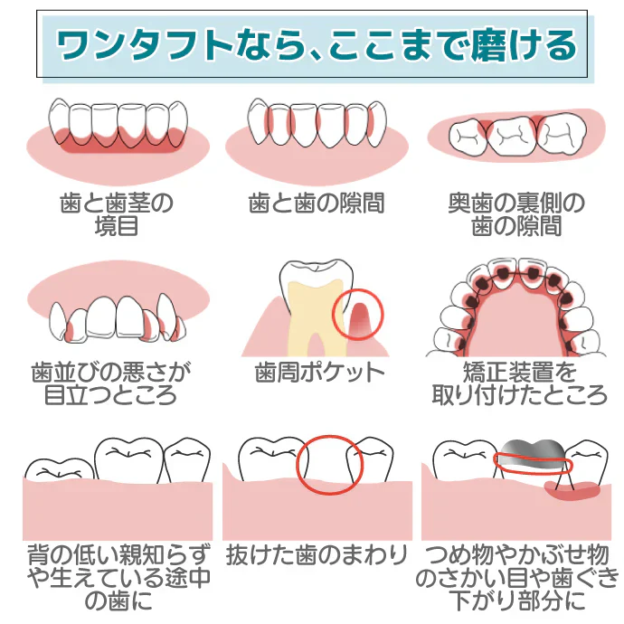 Ci PRO ワンタフトブラシ コンパクトヘッド MSやややわらかめ 10本セット【メール便送料無料】