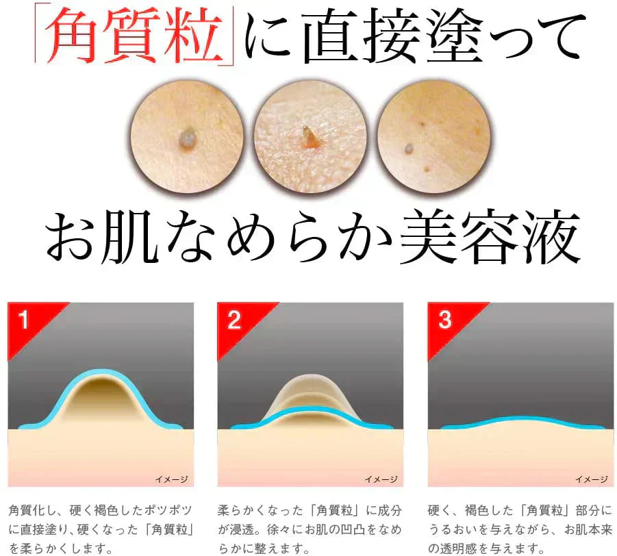 【イポケアEX】首元やフェイスラインのポツポツを集中ケア！ 美容液 角質 ケア スキンケア 顔 首筋 胸元 イボ ポツポツ バチルス発酵液 ヨクイニンエキス ウワウルシ葉エキス イポケア 送料無料 ポツポツ専用 美容液 いぼ取り 除去 お肌のポツポツ 角質 ケアバチルス発酵液 18ml 角質粒 顔 首 肩 胸 美容 ケア お肌 ボディケア ぶつぶつ 日本製 イボの悩み おすすめ 人気 ランキング 効果 強力 最強 角質ケア
