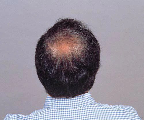 【ブラック】白髪隠し 薄毛隠し 増毛パウダー スプレー 男性 女性 はげ隠し 薄毛隠し / トミーリッチ ブラックヘアー 男女兼用