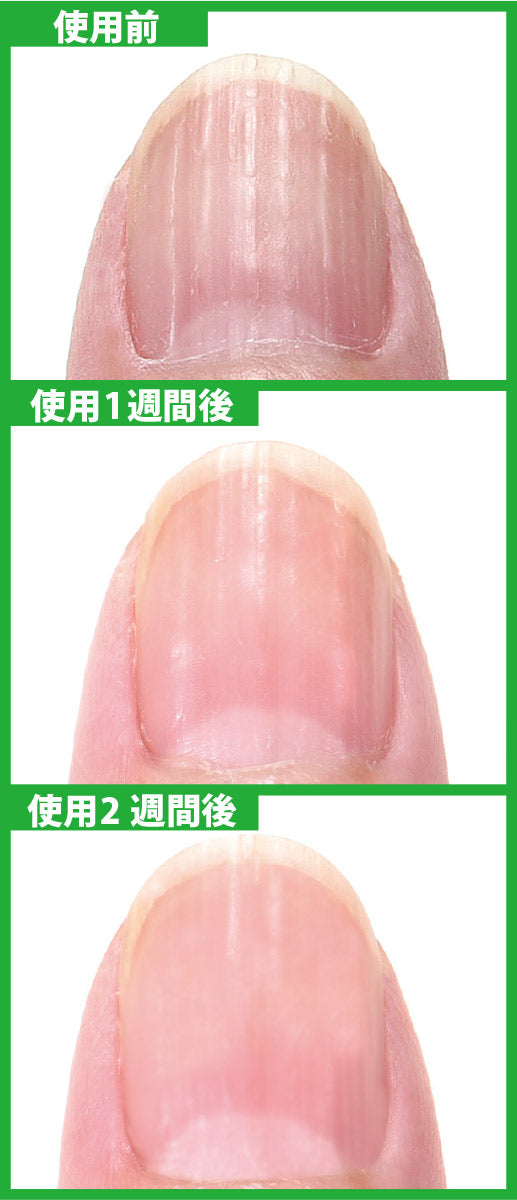 【3人シェア買いでお得】ネイル美容液 キュレ-Qure-(6ml) 1本