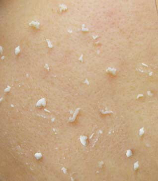 【つるつるたまご肌へ！】医薬部外品 薬用 ピーリングジェル シミケア 角質ケア しみ そばかす くすみ トーンアップ 日本製 / 薬用ノンシミンP 45g