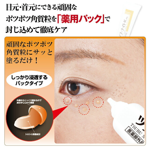 ＼塗って寝るだけイボ取り 目元・首元／ 薬用ツブ・ナイトK 医薬部外品 30g / イボ取り イボケア 角質ケア 角栓 ポツポツ 毛穴 スキンケア 美容液 クリーム 日本製