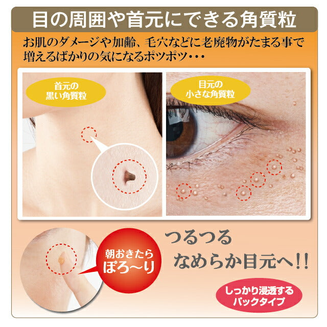 【５個】＼塗って寝るだけイボ取り 目元・首元／ 薬用ツブ・ナイトK 医薬部外品 30g / イボ取り イボケア 角質ケア 角栓 ポツポツ 毛穴 スキンケア 美容液 クリーム エイジングケア 日本製