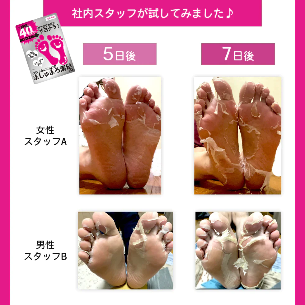 ましゅまろ素足 1回分 かかと 角質除去 足裏  両足×1回分 フットピーリング 時短 フットパック ペロリン 40分履くだけ 角質取り かかと ガサガサ ケア 足の臭い 角質 削る 足の裏 コスメ 化粧品 フットケア メール便 送料無料