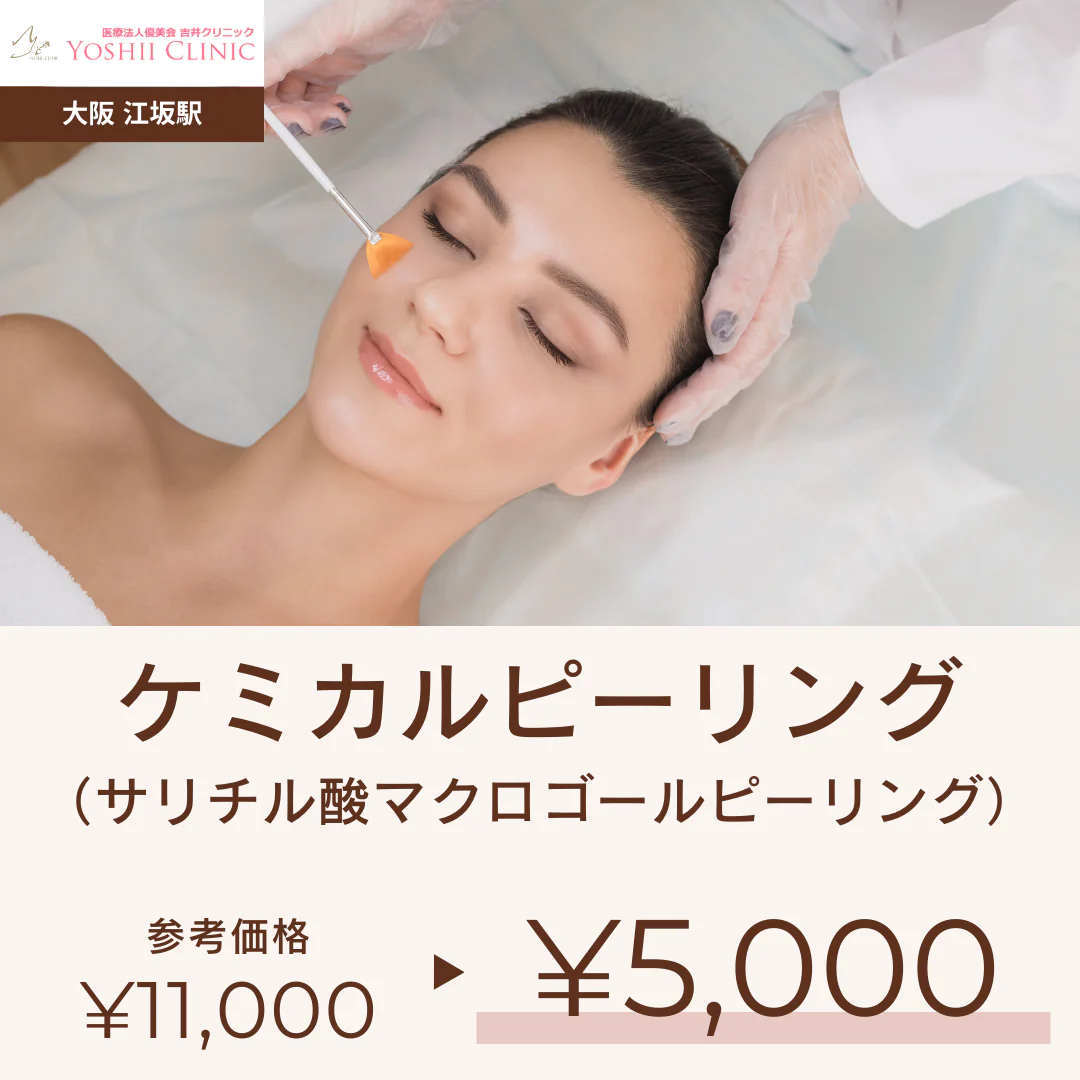 ピーリング（サリチル酸マクロゴールピーリング）・吉井クリニック【美容クリニックチケット】